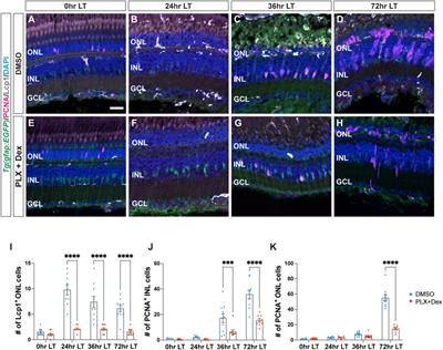 Cytokines IL-1β and IL-10 are required for Müller glia proliferation following light damage in the adult zebrafish retina